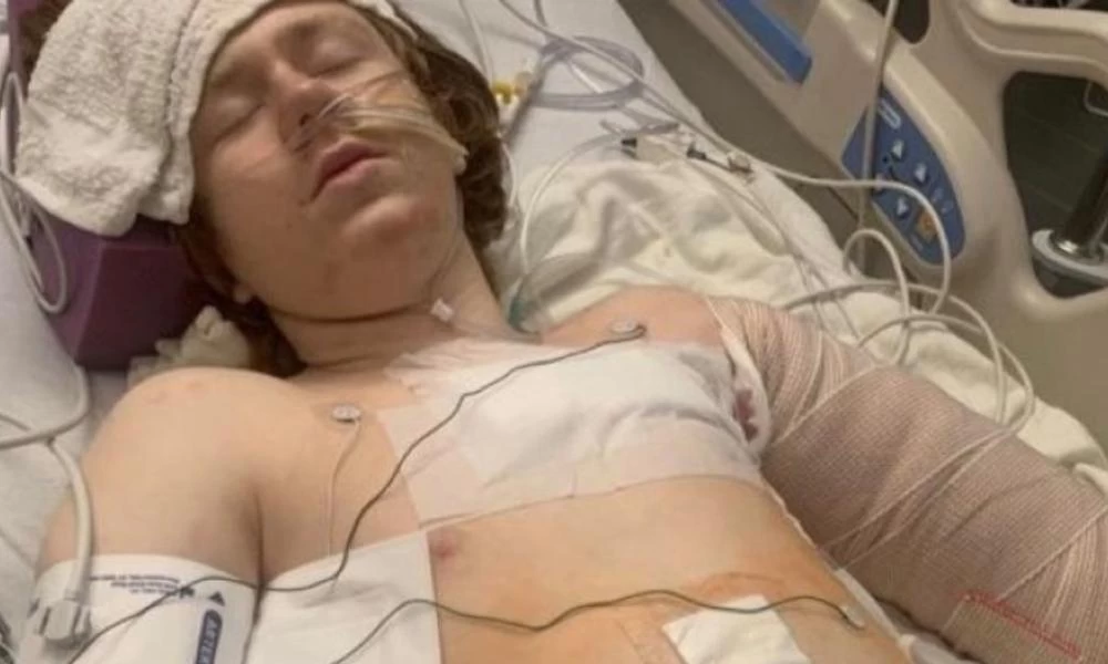 ΗΠΑ: Αστυνομικός πυροβόλησε 13χρονο αυτιστικό παιδί σε κρίση